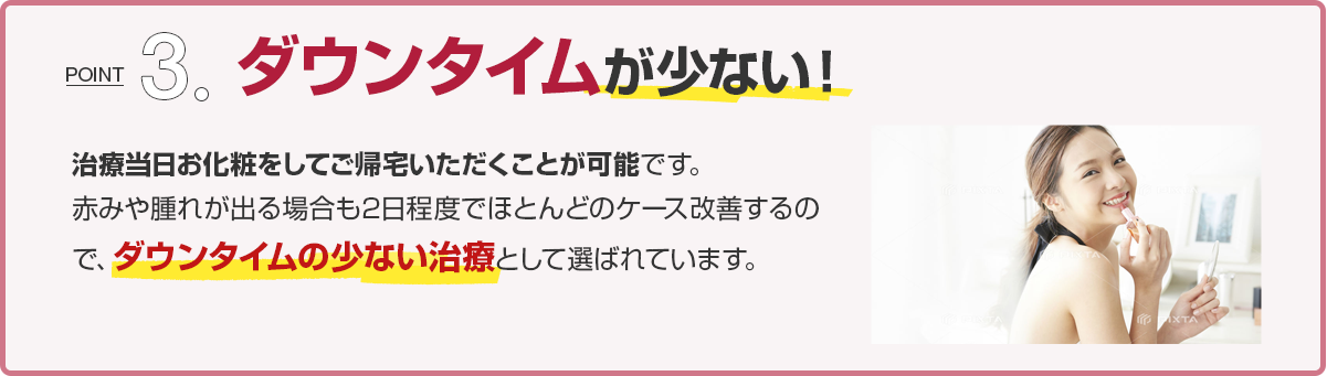 ダウンタイムが少ない！